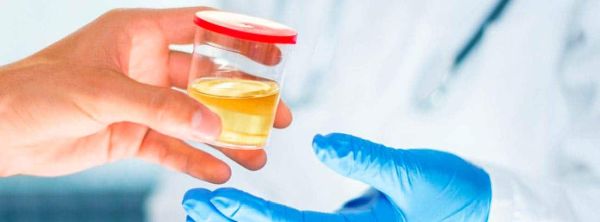 Urine test What does it consist of?